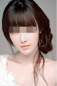 说说面部吸脂特点那点事儿